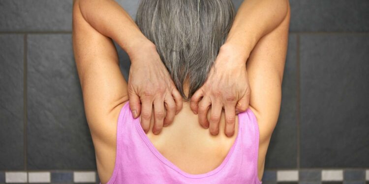 Notalgie paresthésique